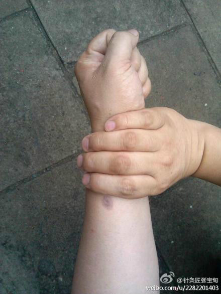 ��Ľ��ű�Ѯ����ҽѧ�ط����ܼ򵥣���Ч��! - Եˮ���� - 