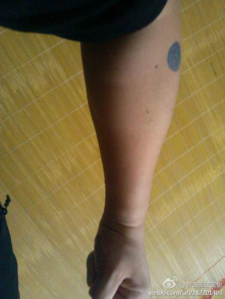 ��Ľ��ű�Ѯ����ҽѧ�ط����ܼ򵥣���Ч��! - Եˮ���� - 