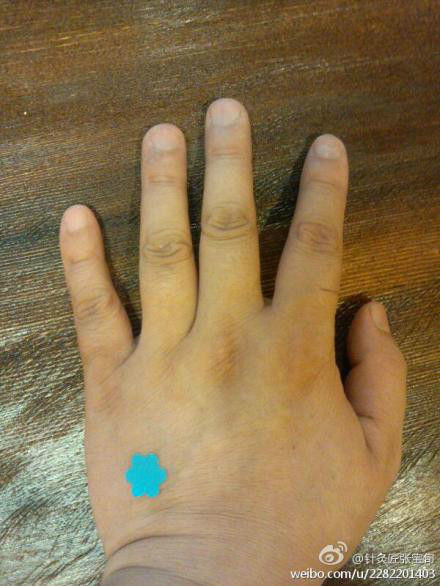 ��Ľ��ű�Ѯ����ҽѧ�ط����ܼ򵥣���Ч��! - Եˮ���� - 