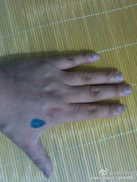 ��Ľ��ű�Ѯ����ҽѧ�ط����ܼ򵥣���Ч��! - Եˮ���� - 