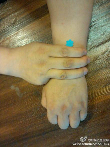 ��Ľ��ű�Ѯ����ҽѧ�ط����ܼ򵥣���Ч��! - Եˮ���� - 