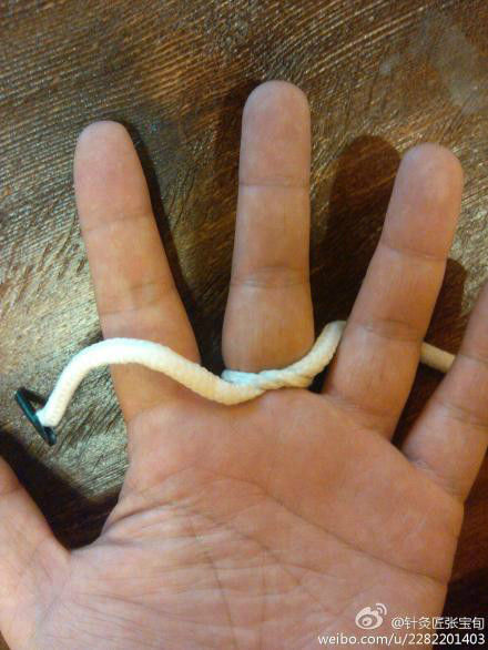 ��Ľ��ű�Ѯ����ҽѧ�ط����ܼ򵥣���Ч��! - Եˮ���� - 